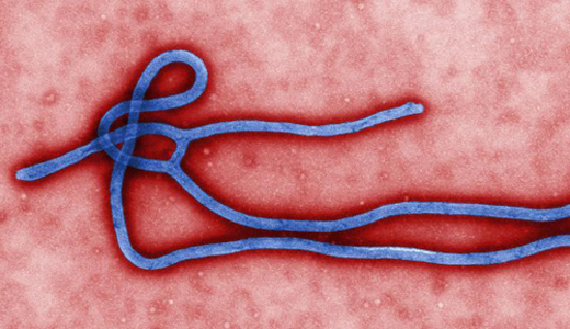 警惕最新病毒病人，你需要了解這些關(guān)鍵信息！