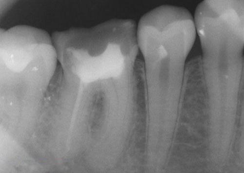 中國(guó)再生牙齒研究新進(jìn)展，重塑微笑，科技引領(lǐng)牙齒再生新篇章