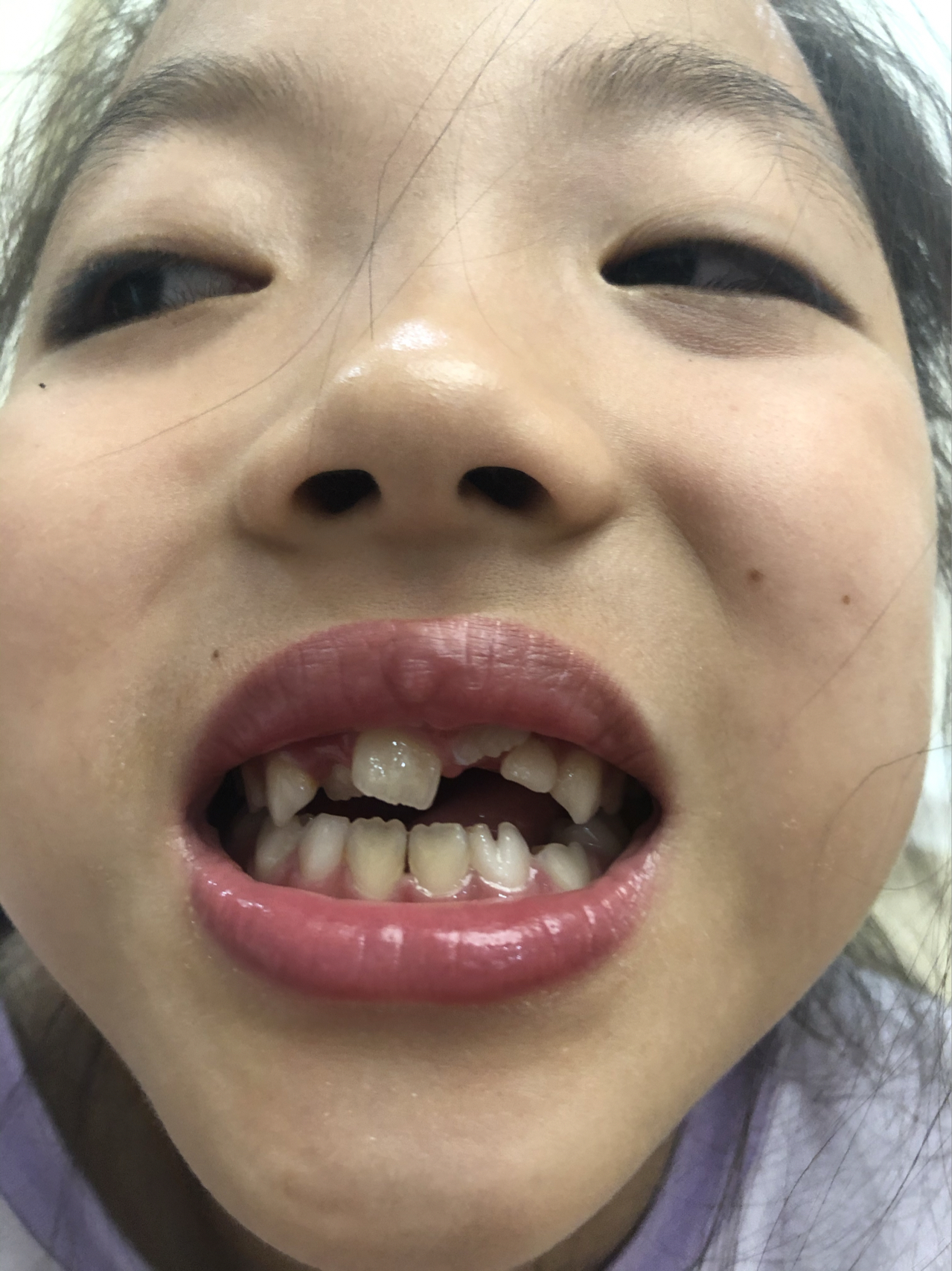 莊最新牙齒技術揭秘，牙齒美容新選擇